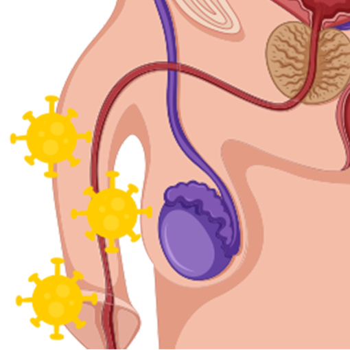 câncer de pênis + sp urologia