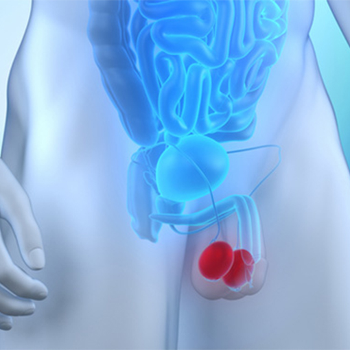 câncer de testículo + sp urologia